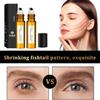 Anti-Wrinkle eye oil organic cold pressed castor oil roll on eye serum Eye Essence Oil Roller Ball Castor Frankincense Rollerball 2 PCS view 3