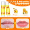 24 Pack Softball Chapstick for Softball Stadium Party Bulk Gifts,Beeswax Moisturizing Lip balm,Vanilla Flavor Plumping Lip balm for softball Team Girls kids Men Women Sports Lovers view 2