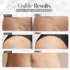 Stretch Marks Cream Hydrates Skin, Supports Elasticity & Collagen,1fl oz view 4