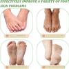 5 Pack Foot Peel Mask Exfoliating Foot Mask Feet Peeling Socks Foot SPA Treatment for Baby Soft Feet Hard Dead Skin Remover Callus Repair Rough Cracked Heels (Tea Tree) view 4