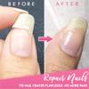Nail Repair Protection Gel, Stick on False Nails Tip for Women, Nail Repair Kit for Split Natural Nail, Clear Builder Base Gel Designed for Women view 4