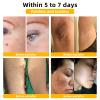 AEEHFENG ADNOON 7-Day Multi-Effect All-in-One Skin Care Cream, ADNOON Skin Care Cream, Professional Bee Venom Skin Care Cream, Fine Line Skin Care Cream for All Skin Types (2 Bottle) view 2