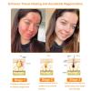 AEEHFENG ADNOON 7-Day Multi-Effect All-in-One Skin Care Cream, ADNOON Skin Care Cream, Professional Bee Venom Skin Care Cream, Fine Line Skin Care Cream for All Skin Types (4 Bottle) view 4