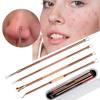 4Pcs/Set Rose Gold Stainless Steel Blackhead Remover Pimple Comedone Double For Head Extractor Cleansing Tools view 2