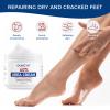 OUKEYA NEW FORMULA Urea Cream 40 Percent for Feet Maximum Strength, Hand Heels Dry Cracked Treatment Lotion for Knees & Elbows, Foot Dead Skin Cuticle Callus Remover Toenail Softener, 5.29 oz view 4