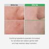 SLLIGHT Cica Bio Spot Control Patch (1 Box, 62pcs) | Soothing Acne Patch for Redness & Blemishes | With Cica, Niacinamide & Tea Tree | Gentle for Sensitive Skin | Korean Skincare view 3