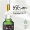 Alra Olive Therapy Serum for Face, Face Serum with 22% Olive Extracts, Reduces Redness & Acne, Rapidly Clear Breakout for Teens Adults, fit Oily & Acne-Prone Skin, 1 fl oz/30ml view 3