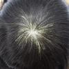 Toupee for Men Fine Mono Mens Toupee Human Hair Thin Skin Front Mens Hair Piece Indian Human Hair Replacement Systems NPU Hair Piece #1B20 1B# OFF BLACK WITH 20% SYNTHETIC GREY view 4