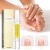 Rejuvenation Nail Growth Oil with Nail File, 3 PCS Nail Oil Pen for Growth And Strength Nails Repair view 2
