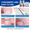 Titanium Alloy Ingrown Toenail Treatment, Nail Tools, and Ingrown Toenail Removal Kit Specially Designed for Curved Nail Repair and Ingrown Toenail Corrector view 3