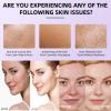 10% Niacinamide+ 4% TXA Serum - Niacinamide Serum for Face - Redness Reducing Skin Care - Face Skin Care to Firm,Smooth,Nourish - Pore Minimizer - Hydrating 10% Niaci namide Se rum Skincare for Women view 4