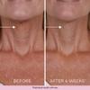 DEKLIDERM Neck Firming Cream  Anti Aging Retinol Cream Visibly Reduces Neck Wrinkles and Sagging  Neck Cream for loss of Firmness view 4