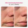 Triple-Pulse IPL Laser Hair Removal, 12cm Sapphire 37F Ice-Cooling Contact, Lazer Hair Removal Device for Women and Men, Permanent Hair Removal at Home for Body, Face, Bikini, Christmas Gifts view 3