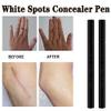 White Spots Concealer Pen Waterproof Long Lasting Vitiligo Scars Birthmarks Cover Pencil Natural Camouflage Makeup Pen, white spots concealer pen view 4