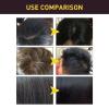 Anti Hair Loss Shampoo,300ml Anti-Hair Fall Loss Shampoo,Promotes Growth for Women (3PC) view 3
