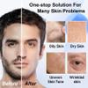 Men Skin Care Kit,Refreshing Skincare Set for Face Wash,Eye Cream,Face Serum,Toner,Moisturizer,Deep Hydrating Men Skincare Gift Set for All Skin Types (5PCS) view 2