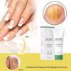 Natural Nail Fungus Treatment Gel - Fungus Cream, Multi-Purpose Nail Repair view 4