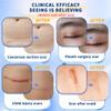 Dermatix Ultra Advanced Scar Gel - 15g, Softens and Flattens Scars, Quick-Drying and Odorless Formula view 3