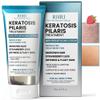 Keratosis Pilaris Treatment | Keratosis Pilaris Lotion | KP Lotion | Gentle Exfoliation For Strawberry Legs, KP & Ingrown Hairs | Smooth & Hydrating Body Lotion For Redness, Dry, Rough And Flaky Skin view 1
