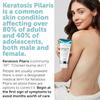 Keratosis Pilaris Treatment | Keratosis Pilaris Lotion | KP Lotion | Gentle Exfoliation For Strawberry Legs, KP & Ingrown Hairs | Smooth & Hydrating Body Lotion For Redness, Dry, Rough And Flaky Skin view 3