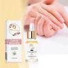MMAX BEAUTY Cuticle Essential Oil 24k Gold for Nail Strength & Smoothness | Rose Jojoba Mineral Nail Oil - Natural Nail Oil Cuticle Softener, Moisturizes & Conditions Cuticles & Nail Beds, 30ml view 2