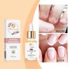 MMAX BEAUTY Cuticle Essential Oil 24k Gold for Nail Strength & Smoothness | Rose Jojoba Mineral Nail Oil - Natural Nail Oil Cuticle Softener, Moisturizes & Conditions Cuticles & Nail Beds, 30ml view 3