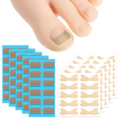 60pcs Ingrown Toenail Corrector Patch and 50pcs Ingrown Toenail Strips Breathable Ingrowns Toenails Stickers Ingrowns Toenails Tape for at Home Ingrown Toenail Treatment Pain Relief and Correction