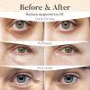 BLOOMORA Caffeine Under Eye Patches (30 Pairs) - Dark Circles & Puffiness Care - Hydrating Caffeine Eye Mask view 4