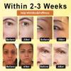 dooeka ApisHeal VenomBoost Collagen Eye Cream, Eye Cream Anti Aging, ApisHeal Instant Eye Firm Cream, Instant Reduces Under Eye Bags, Dark Circles, Puffiness, Anti Aging Fine Lines (4 Bottle) view 3