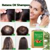 ADUTRY Batana Oil Shampoo, Rosemary Oil Shampoo with Rosemary Extract, Suitable for Men & Women view 3