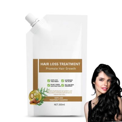 300ml Anti Hair Loss Shampoo For Women, Anti Hair Fall Hair Treatment Shampoo Oil Control Dandruff (1Pcs)