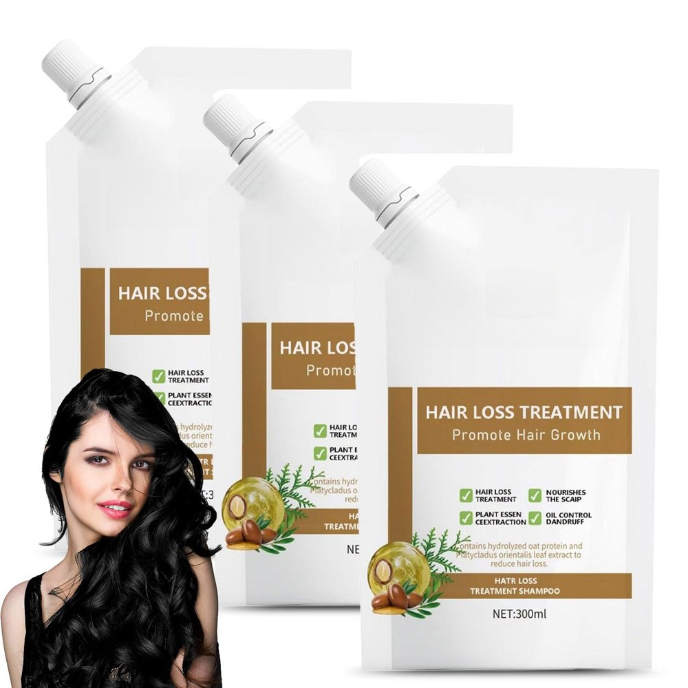 300ml Anti Hair Loss Shampoo For Women, Anti Hair Fall Hair Treatment Shampoo Oil Control Dandruff (3Pcs)
