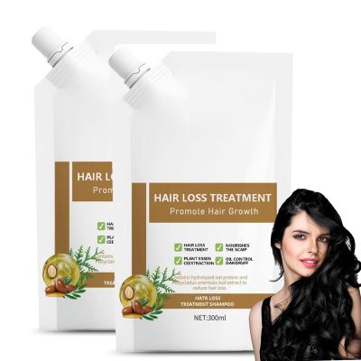 300ml Anti Hair Loss Shampoo For Women, Anti Hair Fall Hair Treatment Shampoo Oil Control Dandruff (2Pcs)