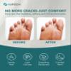 Hydrogen Foot Soak Effervescent Tablets 10 Pack | Ginger & Mugwort Herb Foot Bath, Relaxing Spa Pedicure Care | Improves Circulation, Soothes Tired Feet, Softens Calluses, Controls Odor view 4
