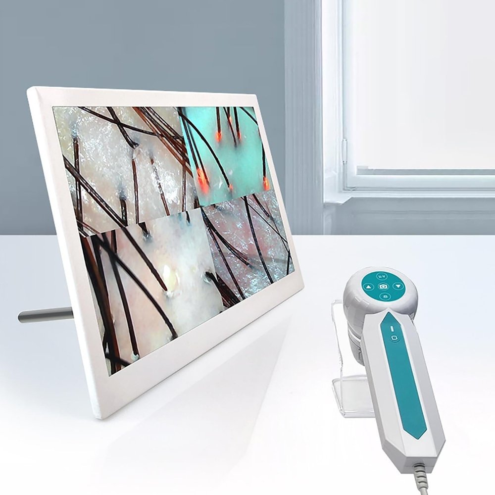 CHIPEL Scalp Hair Detector, Skin Hair Analyzer with Multi-Function Handle, 3 Spectra, Save Pictures, HD Detection, Photo and Freeze, Suitable for Home/Beauty Salon/Spa