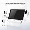 CHIPEL Skin Diagnostic Hair Analyzer 11 Inch, Multi-Function Scalp Detector with Freeze Function, 3 Spectrum Detection, 50X/200X Magnification for Home Beauty Salon Spa view 2