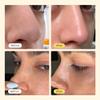 Luelle - Pore Strips, Deep Cleansing Patch System, Blackhead Remover, Nose Plants Strips with 100 PCS, Blackhead Remover Peel off Mask Face & Nose view 2