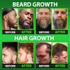 GROW Beard Oil Serum + Biotin Beard Growth Gummies  Beard Growth Kit for Men with 620,000mcg Biotin, Collagen, MSM & Keratin  Thickens Beard, Fills Patches & Supports Hair Growth view 3