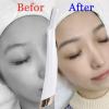 12 Pack Replacement Heads for Finishing Touch Flawless Dermaplane Glo Lighted Facial Exfoliator Blades, Replacement Blades for Facial and Eyebrow Hair, Stainless Steel Heads view 2