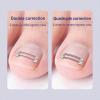 Cuttable Adjustable Titanium Alloy Silicone Ingrown Correction Kit,Ingrown Toenail Treatment,Ingrown Toenail Removal Kit,Designed for Ingrown Nail Repair, Ingrown Toenail Corrector at Home,reusable view 2