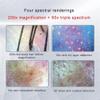 CHIPEL Skin Scalp Analyser, 11 Inch HD LCD Screen Microscope Tester with 50X 200X HD Lenses,Skin Health Analyzer, Skin Detector Facial Skin Moisture Detector Tester view 2