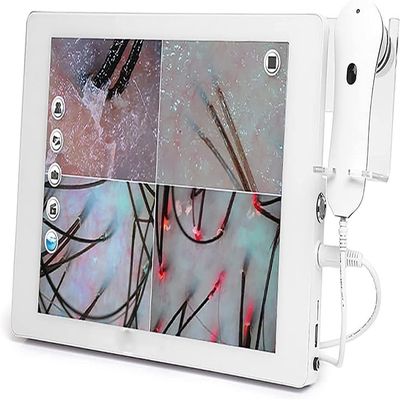 CHIPEL Skin Diagnosis Hair Analyzer,Scalp Detector,High Definition Touch Screen,Configure Dual Lens,32g of Large Memory,Used to Detect Skin and Hair Health Status