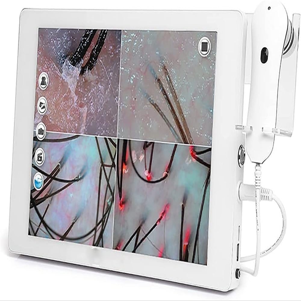CHIPEL Skin Diagnosis Hair Analyzer,Scalp Detector,High Definition Touch Screen,Configure Dual Lens,32g of Large Memory,Used to Detect Skin and Hair Health Status