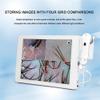 CHIPEL Skin Diagnosis Hair Analyzer,Scalp Detector,High Definition Touch Screen,Configure Dual Lens,32g of Large Memory,Used to Detect Skin and Hair Health Status view 4