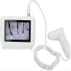 CHIPEL Skin Diagnosis Hair Analyzer, 5 Inch LCD Screen Digital Skin Diagnosis Scanner System, Skin Hair Blackhead Scalp Detector Skin Hair Scalp Detector view 1