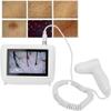 CHIPEL Skin Diagnosis Hair Analyzer, 5 Inch LCD Screen Digital Skin Diagnosis Scanner System, Skin Hair Blackhead Scalp Detector Skin Hair Scalp Detector view 4