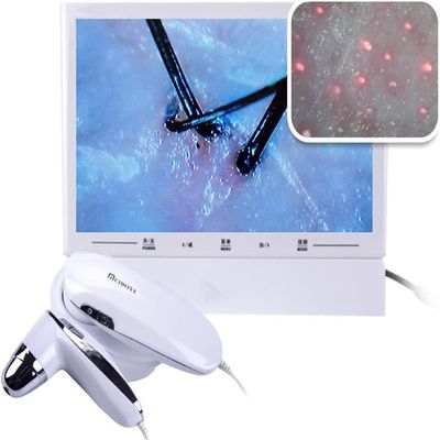 CHIPEL Skin Scalp Analyser, 11 Inch HD LCD Screen Microscope Tester with 50X 200X HD Lenses,Skin Health Analyzer, Skin Detector Facial Skin Moisture Detector Tester