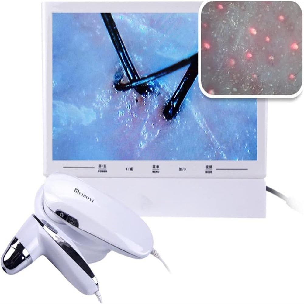 CHIPEL Skin Scalp Analyser, 11 Inch HD LCD Screen Microscope Tester with 50X 200X HD Lenses,Skin Health Analyzer, Skin Detector Facial Skin Moisture Detector Tester