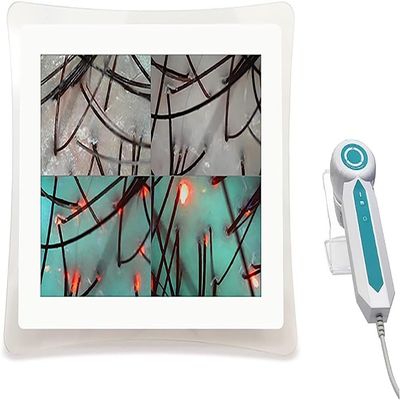 CHIPEL Skin Diagnosis Hair Analyzer,Scalp Follicle Detector Machine,with USB Storage Function,Comparison of Four Palaces, for Skin Problems, Follicle Testing and Skin Analysis