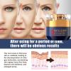 Plutarn Qingling Crema Para Arrugas, Qingling Face Cream, Qingling Wrinkle Removal Cream, Polypeptide Tightening and Anti Wrinkle Cream, Anti Aging Moisturizer for Firming Face (2pcs) view 4